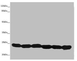 Western blot. All lanes: TMED10 antibody at 4.88µg/ml. Lane 1: Hela whole cell lysate. Lane 2: Mouse liver tissue. Lane 3: Mouse lung tissue. Lane 4: 293T whole cell lysate. Lane 5: NIH/3T3 whole cell lysate. Lane 6: U87 whole cell lysate. Secondary. Goat polyclonal to rabbit IgG at 1/10000 dilution. Predicted band size: 25 kDa. Observed band size: 25 kDa