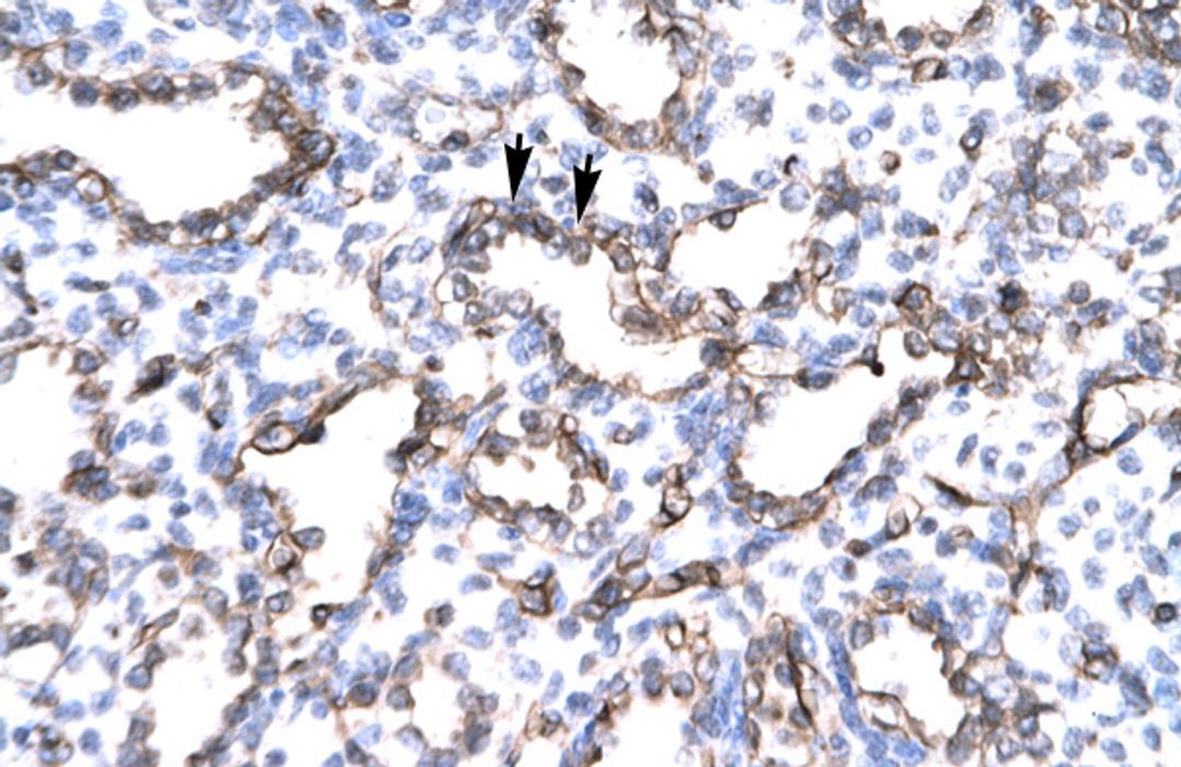 Antibody used in IHC on Human Lung.