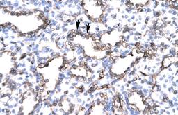 Antibody used in IHC on Human Lung.