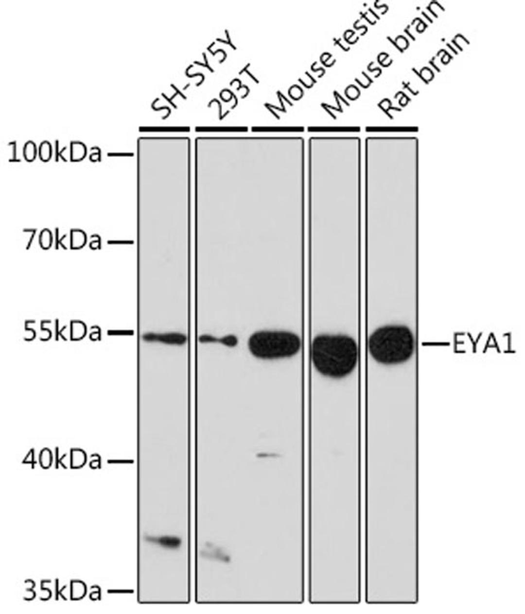 Western blot - EYA1 Rabbit pAb (A9534)