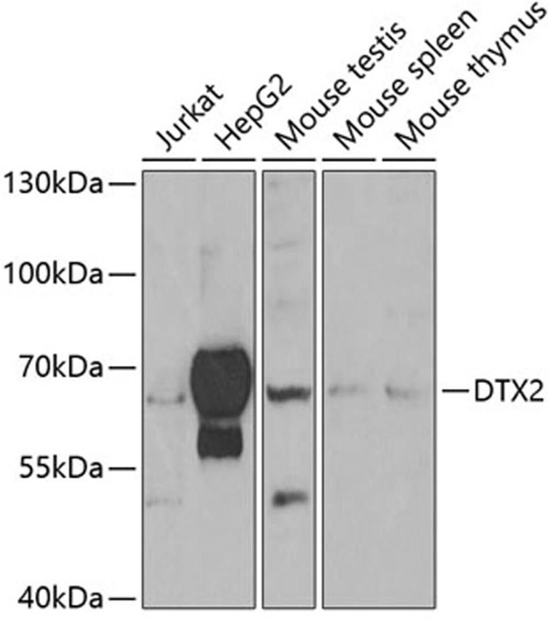 Western blot - DTX2 antibody (A7398)