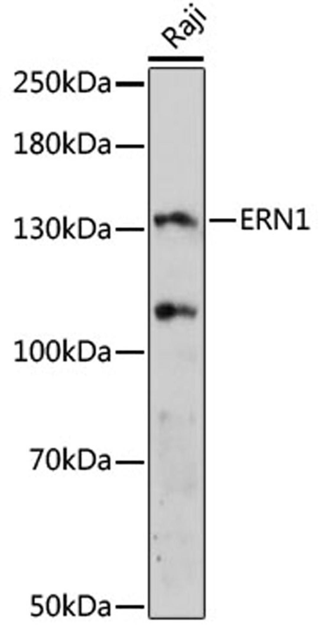 Western blot - ERN1 antibody (A17940)