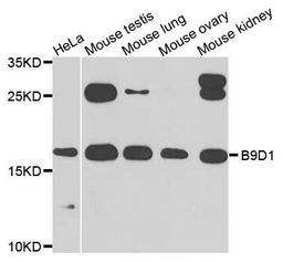 Western blot analysis of extracts of various cells using B9D1 antibody