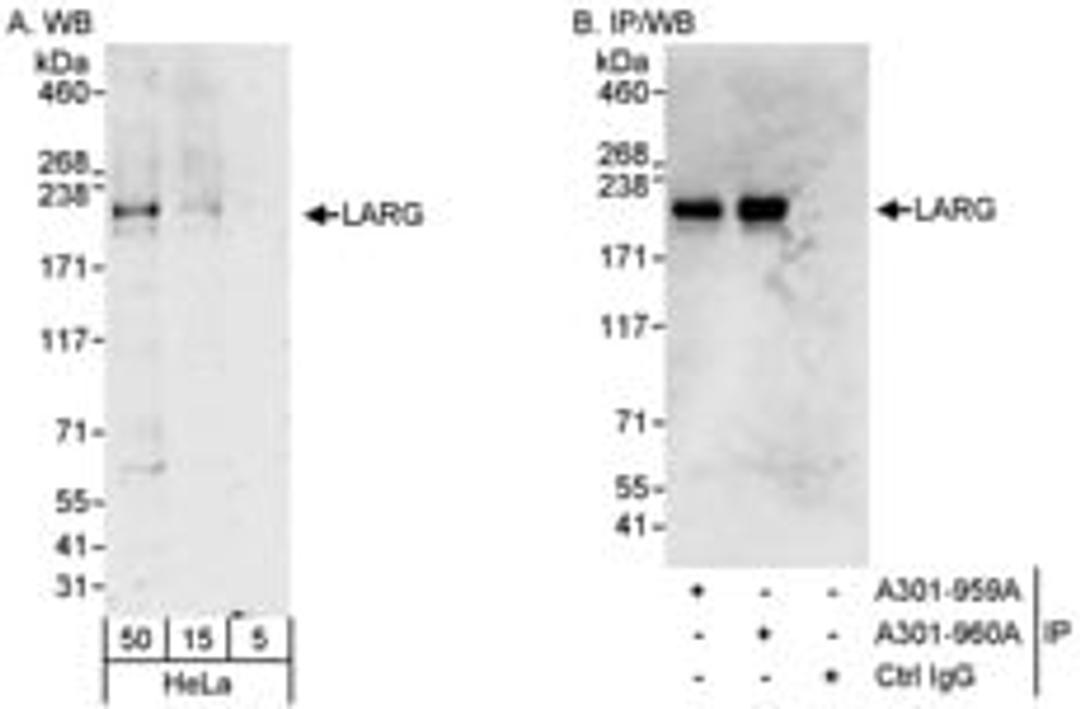 Detection of human LARG by western blot and immunoprecipitation.