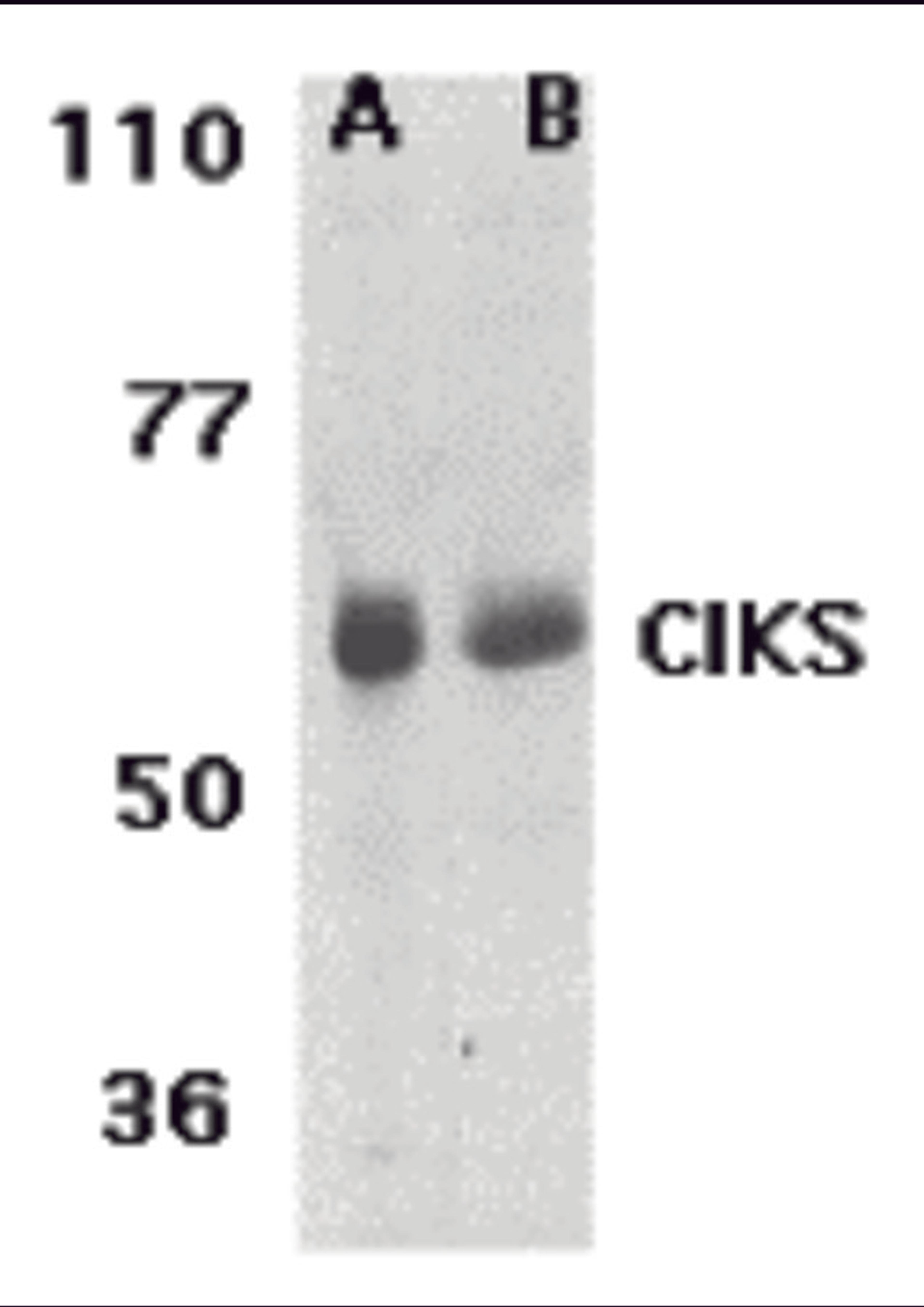 Western blot analysis of CIKS expression in human lung (lane A) and placenta (lane B) tissue lysates with CIKS antibody at 1 &#956;g /ml.