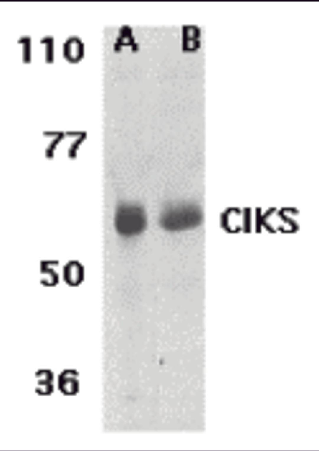 Western blot analysis of CIKS expression in human lung (lane A) and placenta (lane B) tissue lysates with CIKS antibody at 1 μg /ml.