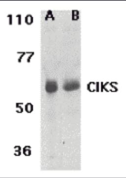 Western blot analysis of CIKS expression in human lung (lane A) and placenta (lane B) tissue lysates with CIKS antibody at 1 μg /ml.
