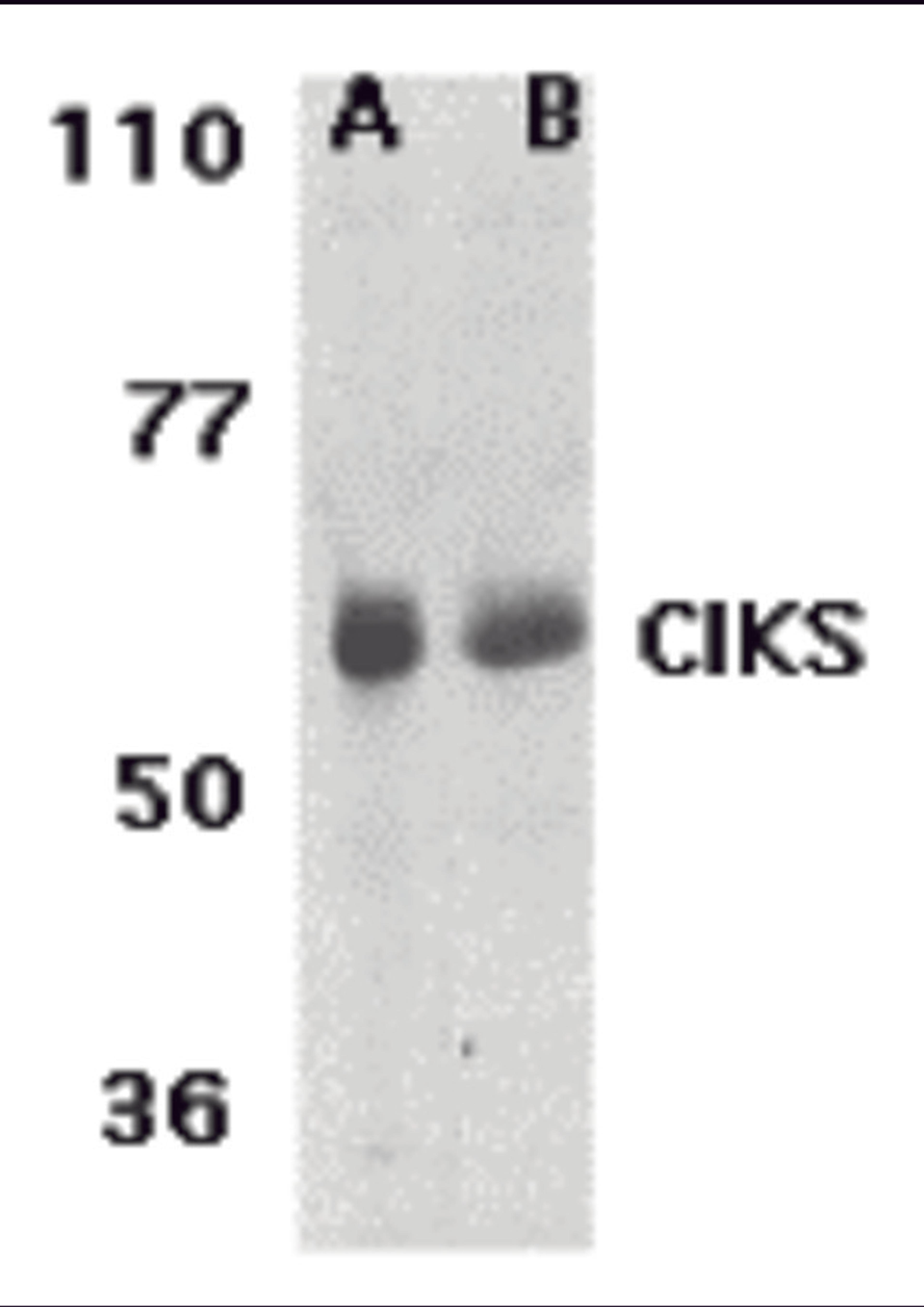 Western blot analysis of CIKS expression in human lung (lane A) and placenta (lane B) tissue lysates with CIKS antibody at 1 μg /ml.