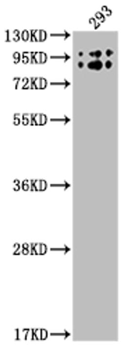 Western Blot. Positive WB detected in: 293 whole cell lysate. All lanes: BCHE antibody at 1:2000. Secondary. Goat polyclonal to rabbit IgG at 1/50000 dilution. Predicted band size: 69 kDa. Observed band size: 90 kDa. 
