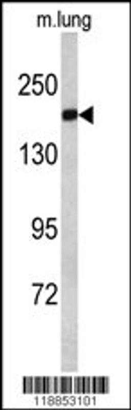 Western blot analysis of ALS2 antibody in mouse lung tissue lysates (35ug/lane)