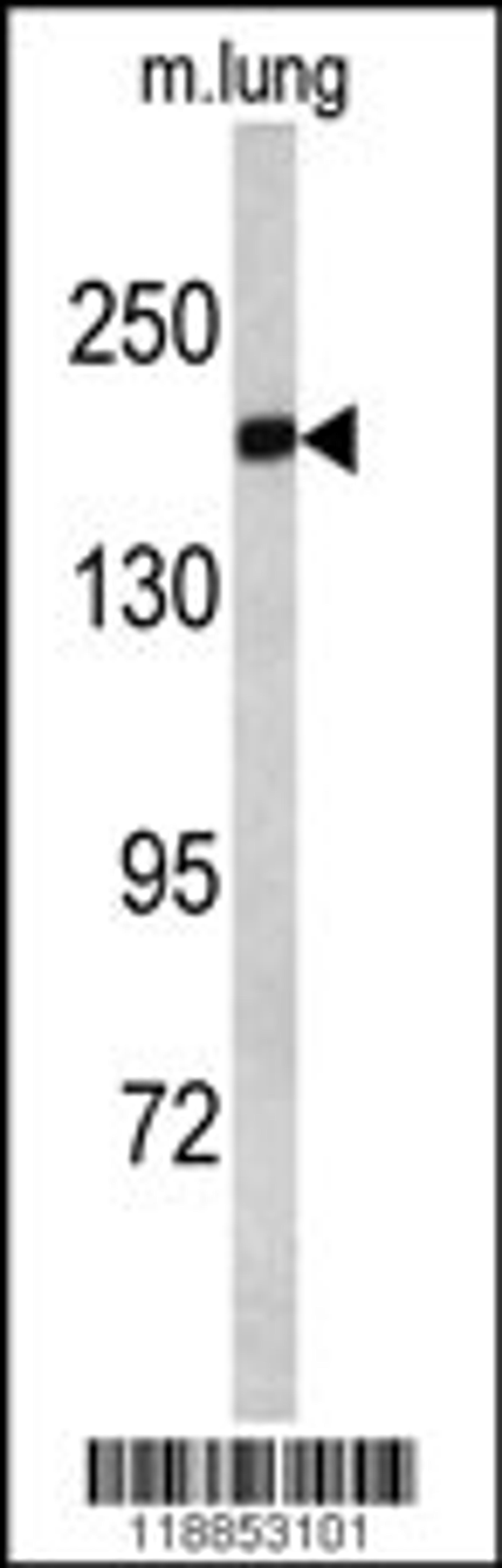 Western blot analysis of ALS2 antibody in mouse lung tissue lysates (35ug/lane)