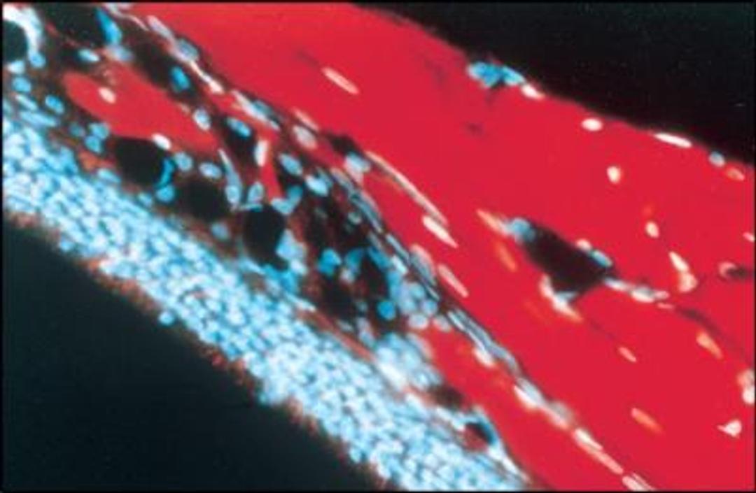 Immunocytochemistry/Immunofluorescence: MAP1B Antibody (AA6) [NB600-1446] - Staining of polyester wax section through adult rat olfactory sensory epithelium using Monoclonal Anti-MAP1b, clone No. AA6 showing intense reactivity in the olfactory nerve (red). Cell nuclei fluoresce blue due to Hoechst counterstain.