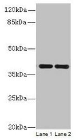 Western blot. All lanes: CCDC42 antibody at 0.8µg/ml. Lane 1: Mouse brain tissue. Lane 2: Mouse heart tissue. Secondary. Goat polyclonal to Rabbit IgG at 1/10000 dilution. Predicted band size: 39, 30 kDa. Observed band size: 39 kDa
