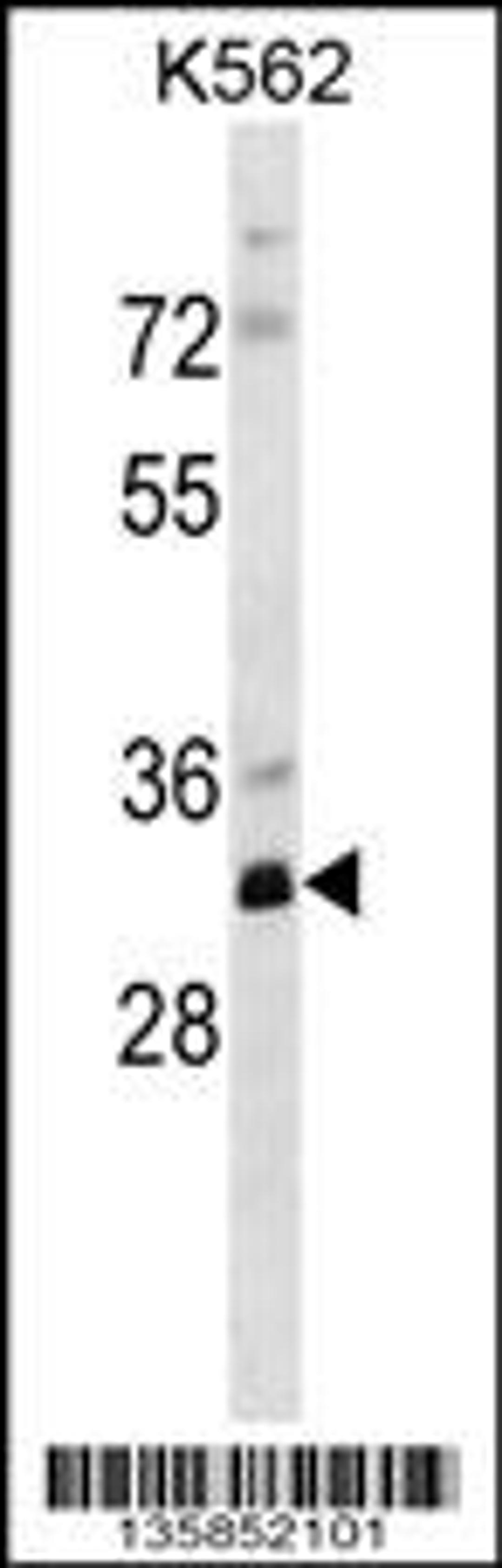 Western blot analysis in K562 cell line lysates (35ug/lane).