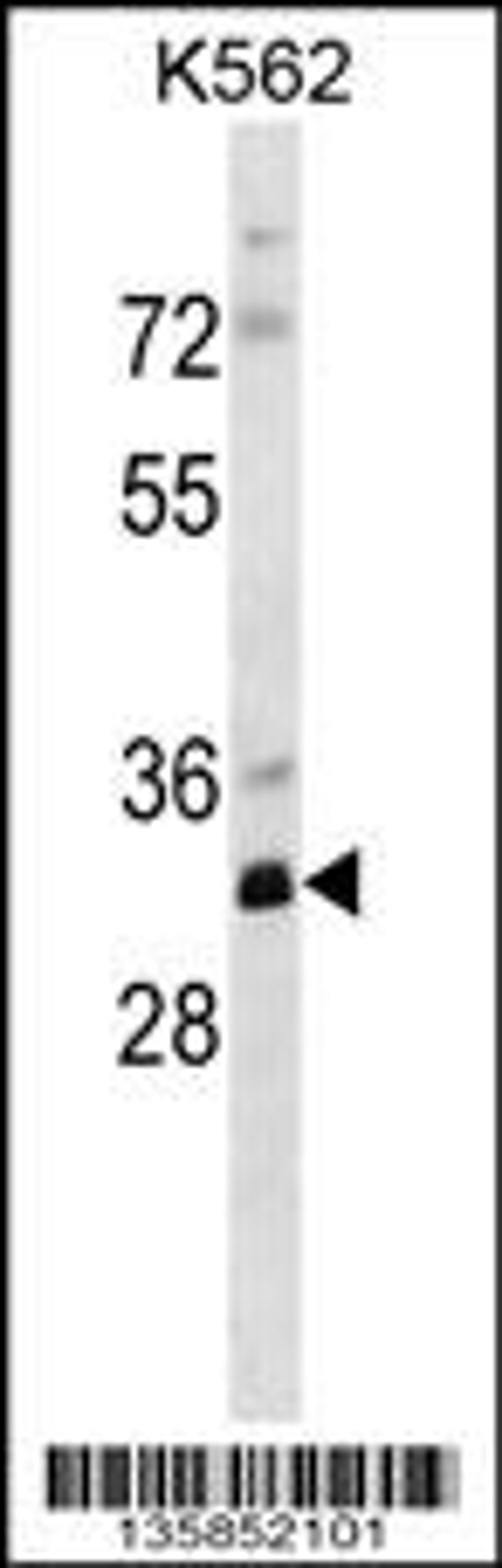 Western blot analysis in K562 cell line lysates (35ug/lane).