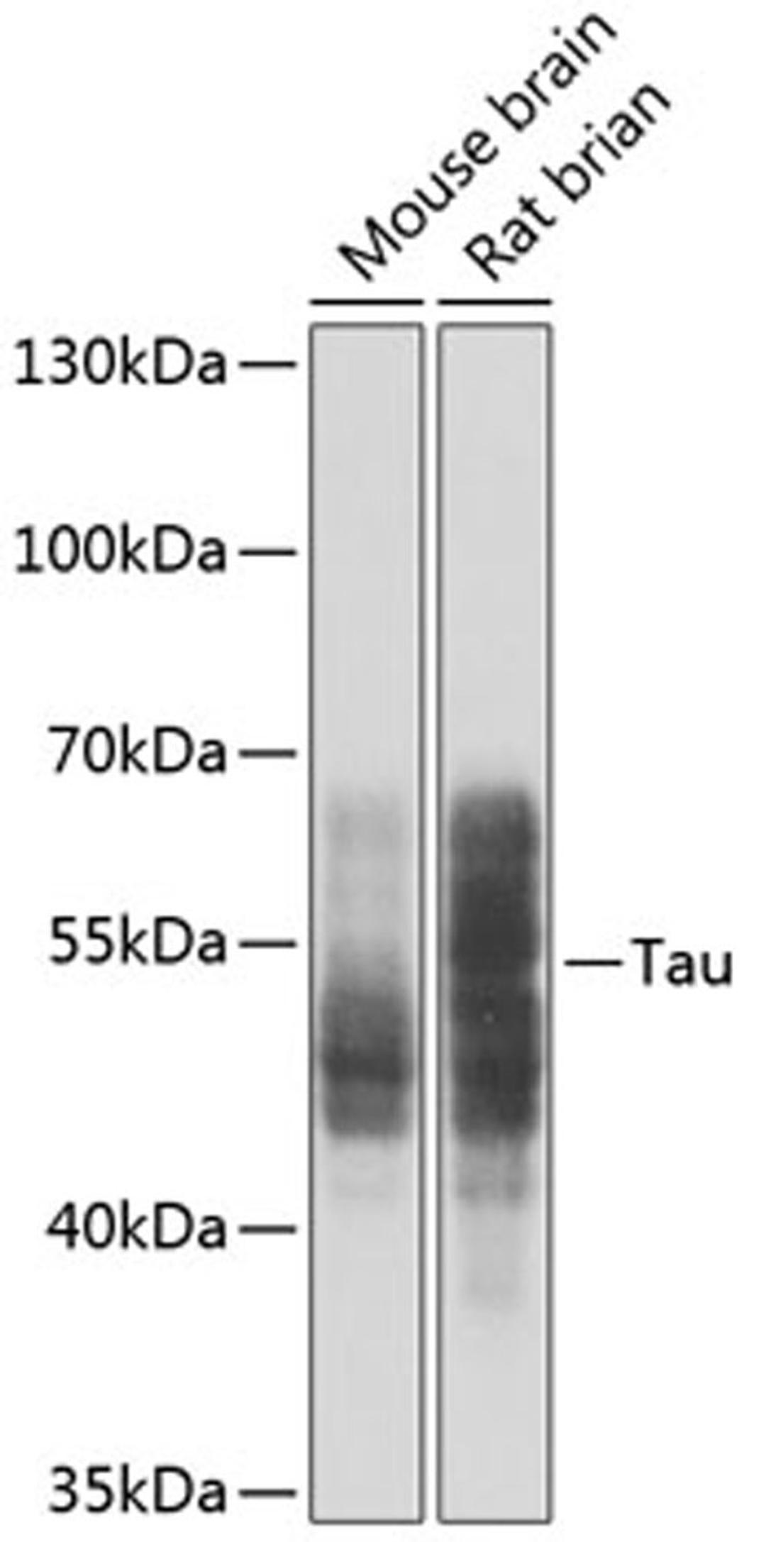 Western blot - Tau antibody (A0002)