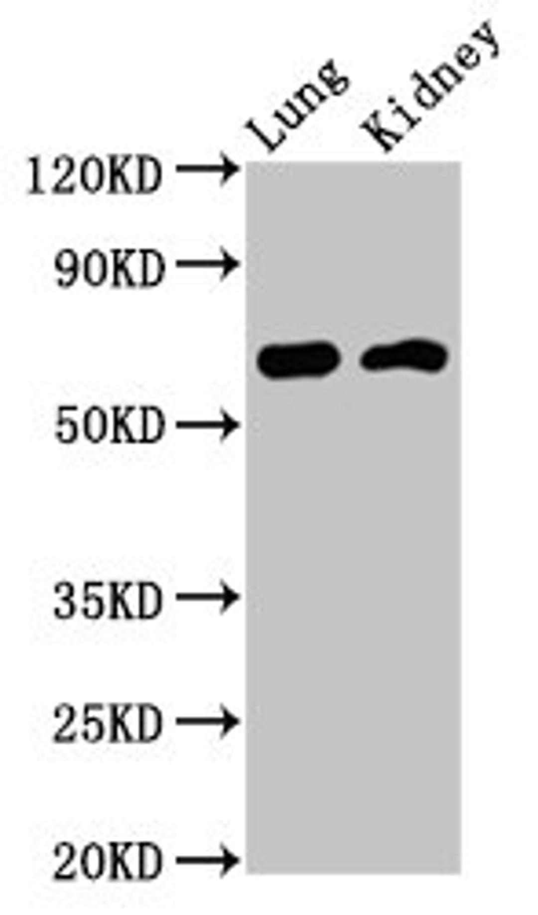 Western Blot. Positive WB detected in: Rat lung tissue, Mouse kidney tissue. All lanes: IQCB1 antibody at 3.2ug/ml. Secondary. Goat polyclonal to rabbit IgG at 1/50000 dilution. Predicted band size: 69, 54, 35 kDa. Observed band size: 69 kDa. 