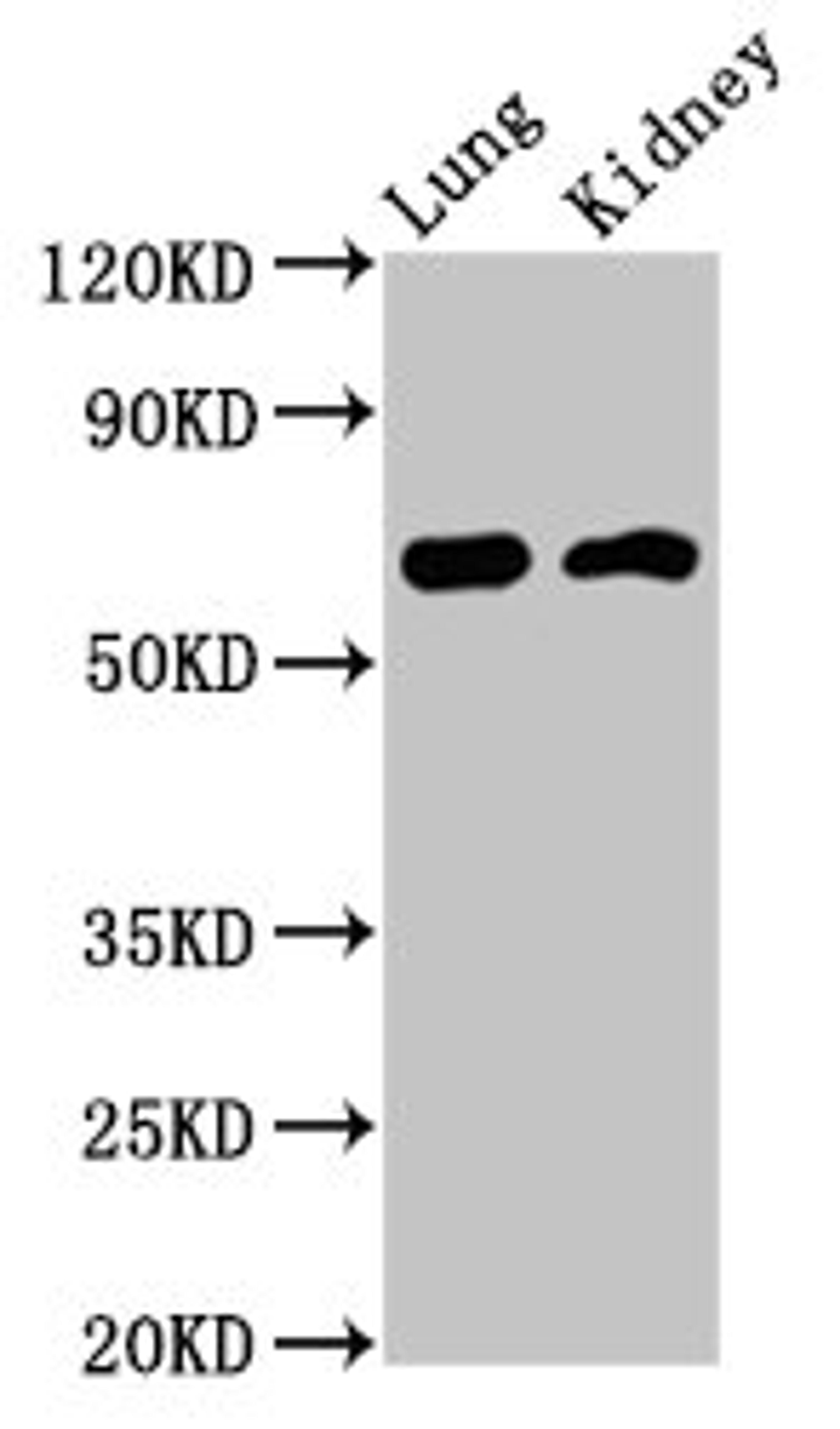 Western Blot. Positive WB detected in: Rat lung tissue, Mouse kidney tissue. All lanes: IQCB1 antibody at 3.2ug/ml. Secondary. Goat polyclonal to rabbit IgG at 1/50000 dilution. Predicted band size: 69, 54, 35 kDa. Observed band size: 69 kDa. 