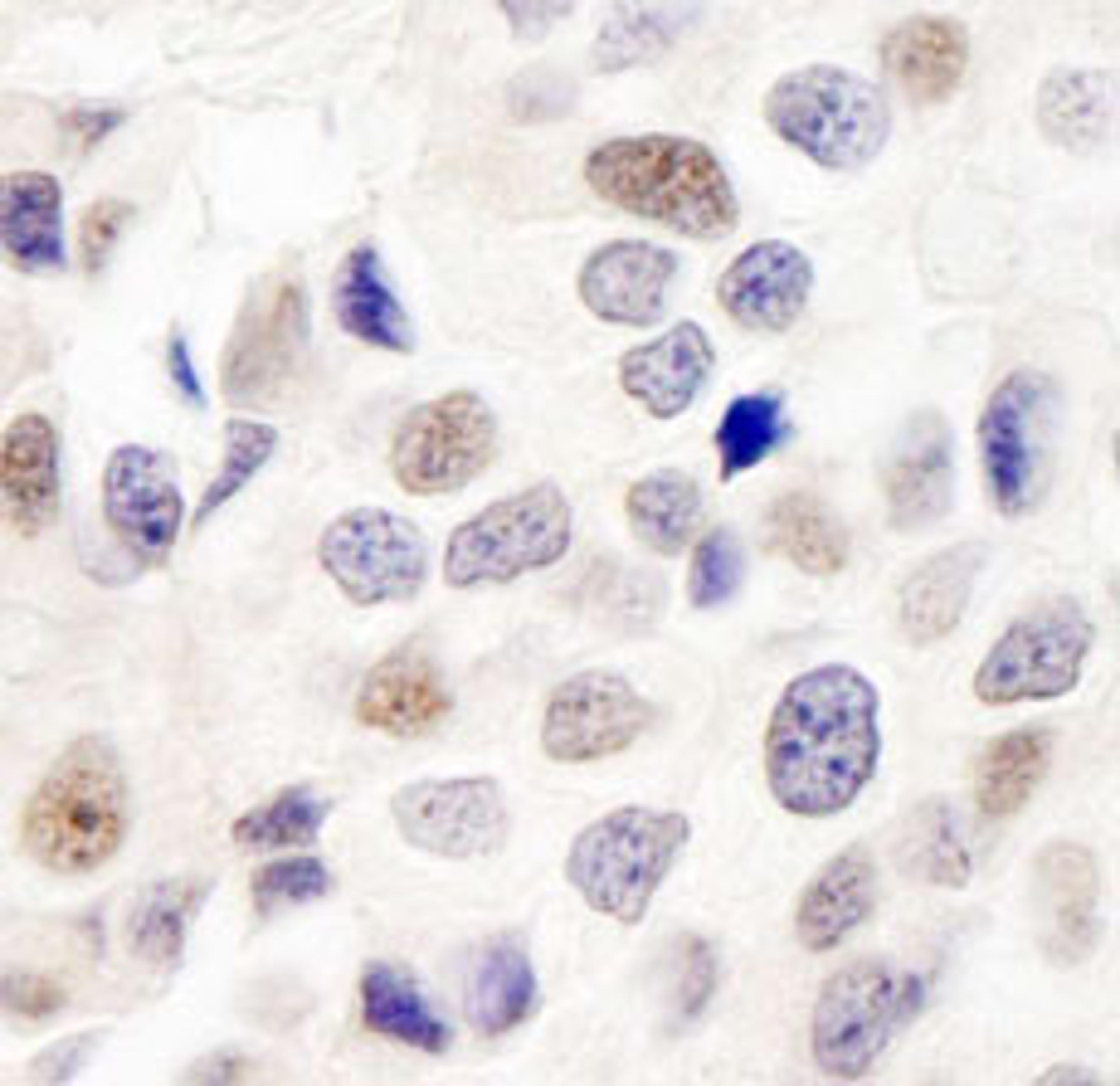 Detection of human INT7 by immunohistochemistry.