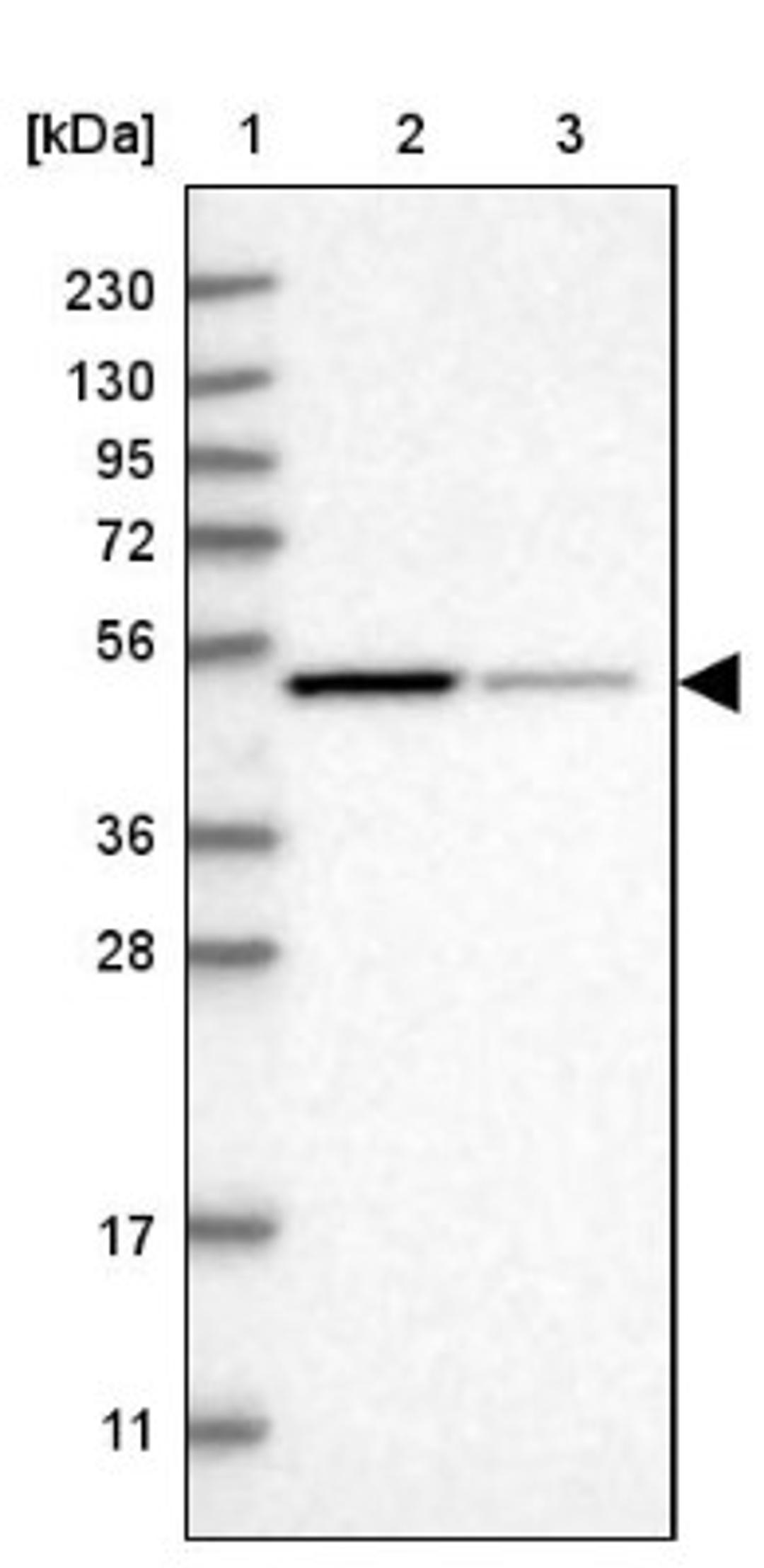 Western Blot: NSUN7 Antibody [NBP1-94011] - Lane 1: Marker [kDa] 230, 130, 95, 72, 56, 36, 28, 17, 11<br/>Lane 2: Human cell line RT-4<br/>Lane 3: Human cell line U-251MG sp