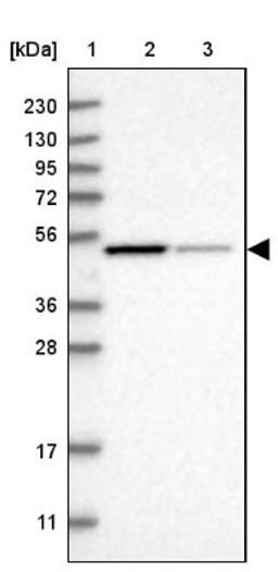 Western Blot: NSUN7 Antibody [NBP1-94011] - Lane 1: Marker [kDa] 230, 130, 95, 72, 56, 36, 28, 17, 11<br/>Lane 2: Human cell line RT-4<br/>Lane 3: Human cell line U-251MG sp