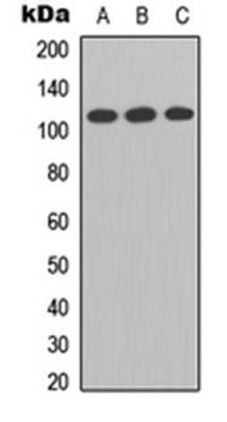 Western blot analysis of A549 (Lane 1), Raw264.7 (Lane 2), PC12 (Lane 3) whole cell lysates using Enterokinase LC antibody