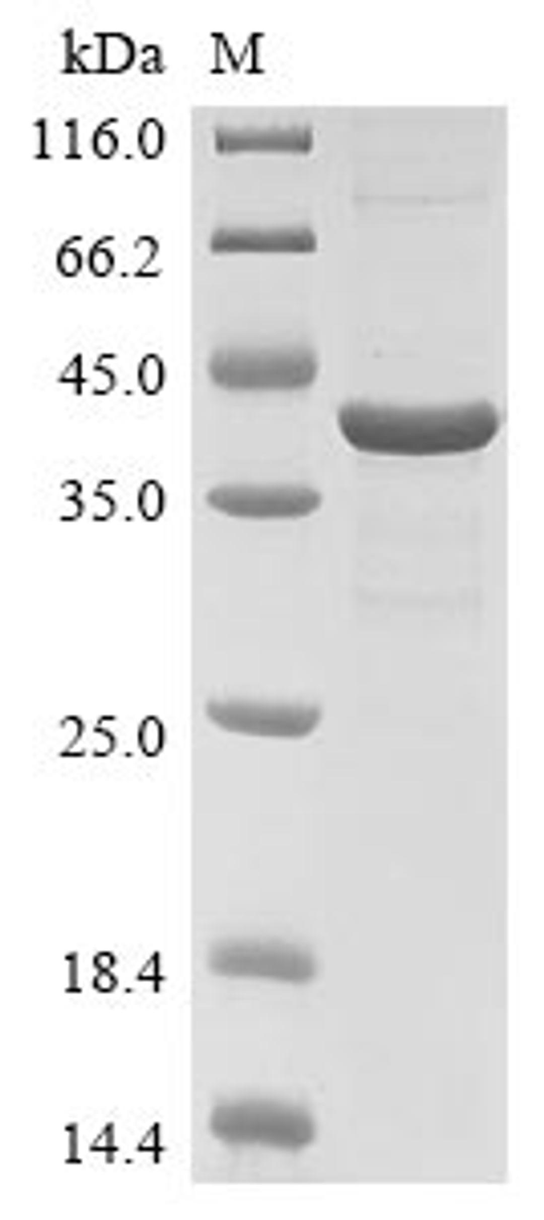 (Tris-Glycine gel) Discontinuous SDS-PAGE (reduced) with 5% enrichment gel and 15% separation gel.