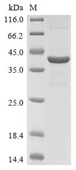 (Tris-Glycine gel) Discontinuous SDS-PAGE (reduced) with 5% enrichment gel and 15% separation gel.