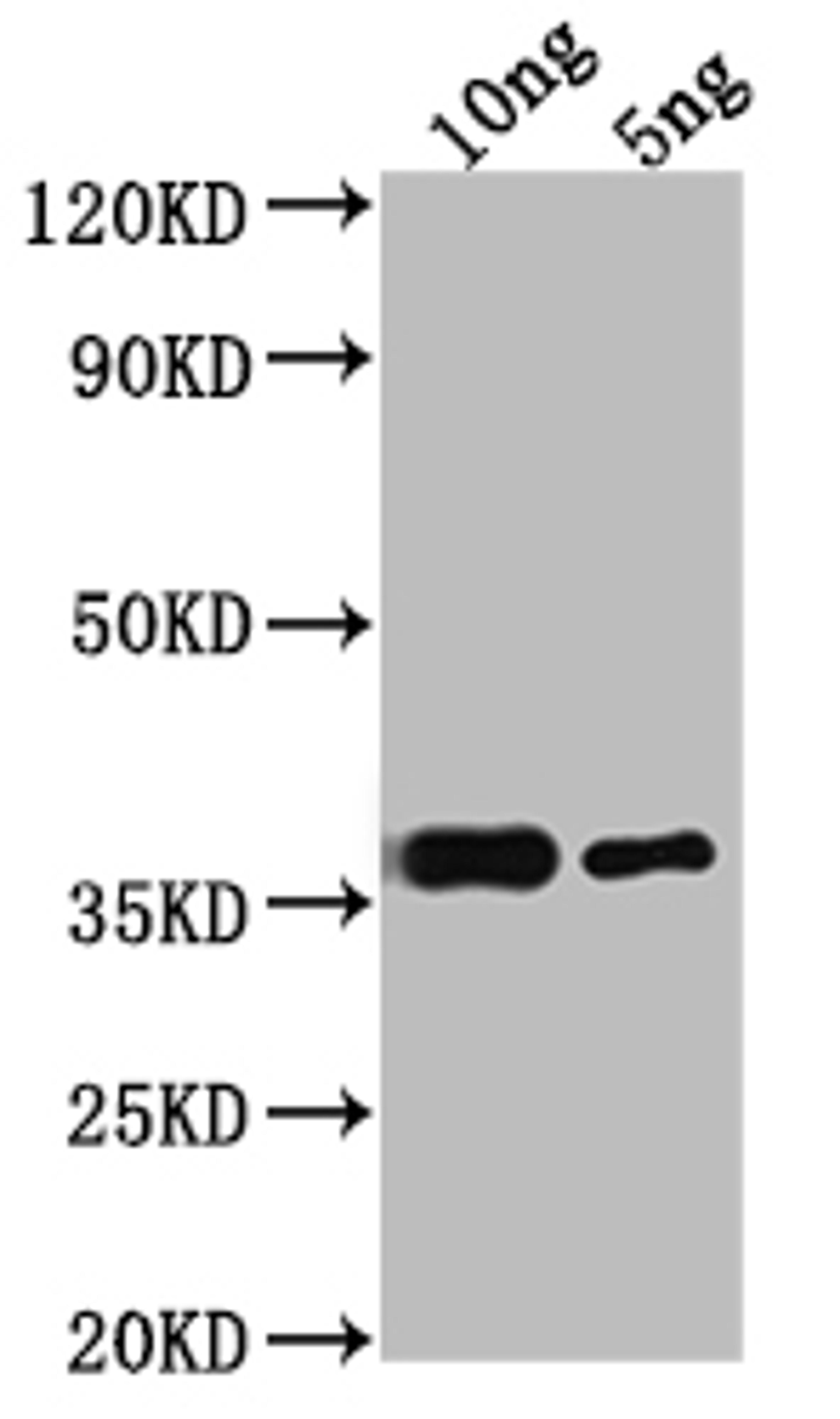 Western Blot. Positive WB detected in Recombinant protein. All lanes: RPB10 antibody at 1:2000. Secondary. Goat polyclonal to rabbit IgG at 1/50000 dilution. Predicted band size: 34.8 kDa. Observed band size: 38 kDa.