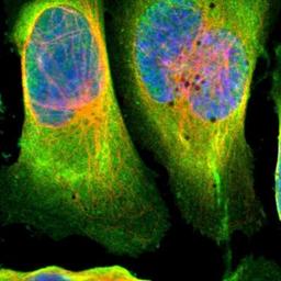 Immunocytochemistry/Immunofluorescence: Dimethylarginine Dimethylaminohydrolase 1/DDAH1 Antibody [NBP1-85273] - Staining of human cell line U-2 OS shows positivity in plasma membrane & cytoplasm.