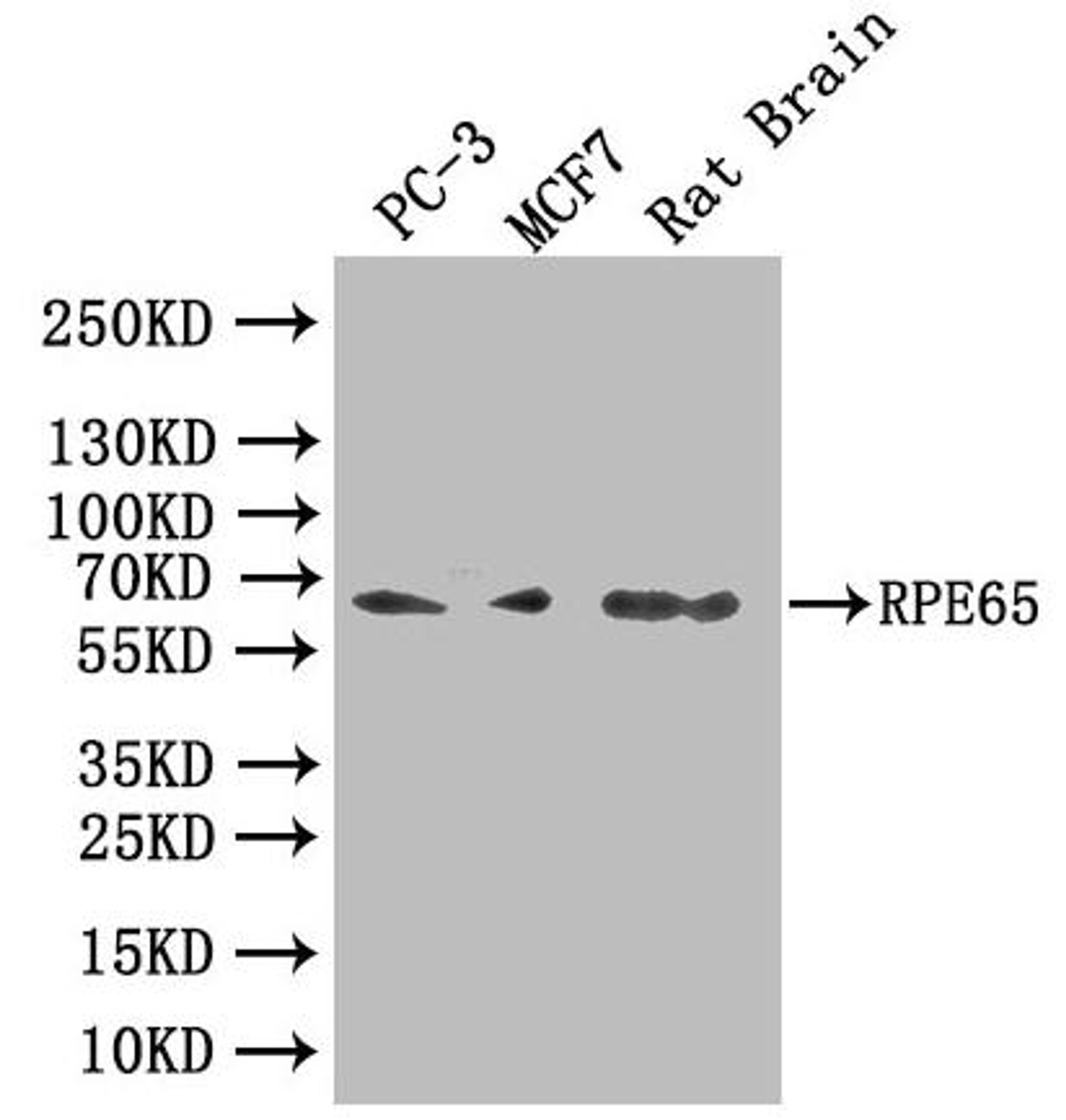 Western Blot. Positive WB detected in: Rat brain tissue. All lanes: RPE65 antibody at 2.3ug/ml. Secondary. Goat polyclonal to rabbit IgG at 1/50000 dilution. Predicted band size: 61 kDa. Observed band size: 61 kDa. 