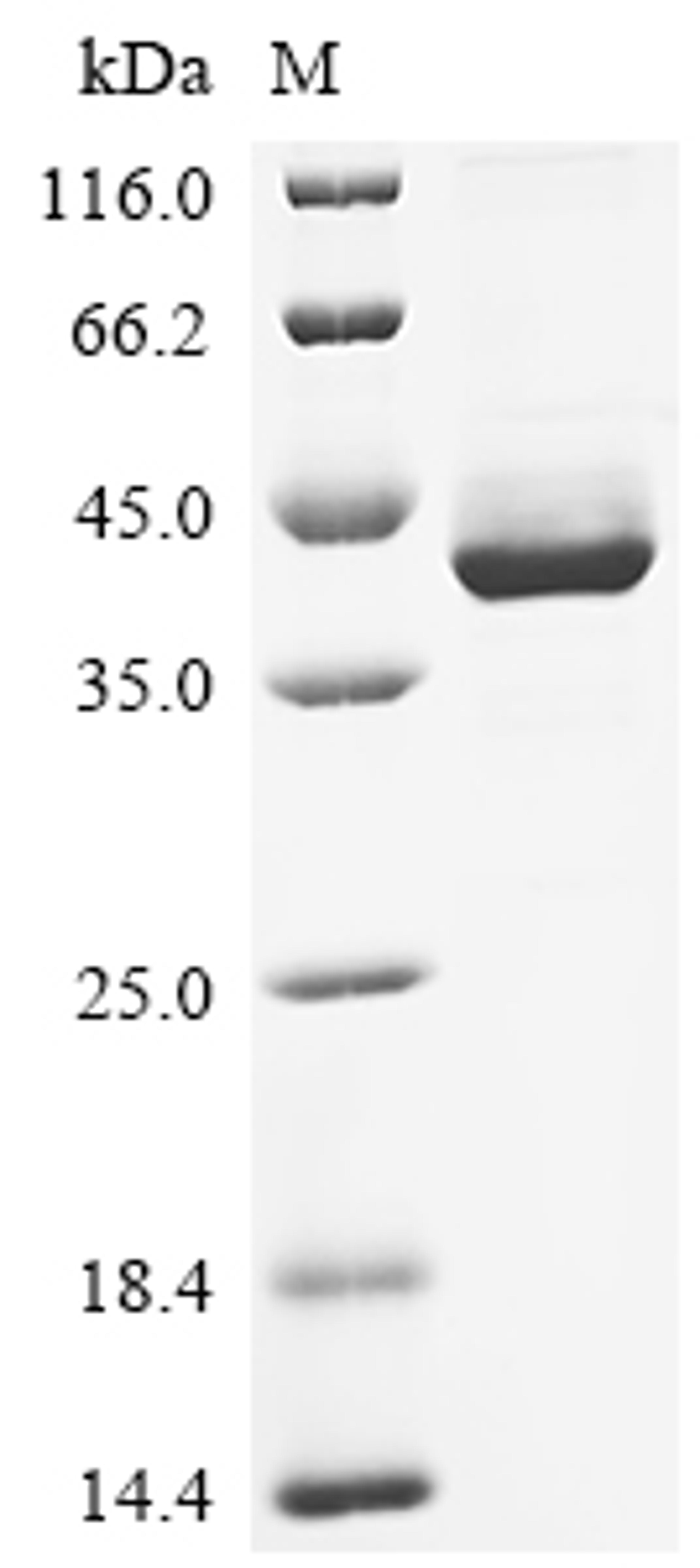 (Tris-Glycine gel) Discontinuous SDS-PAGE (reduced) with 5% enrichment gel and 15% separation gel.