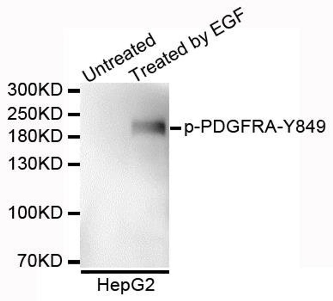 Western blot analysis of extracts of HepG2 cells using PDGFRA (Phospho-Y849) antibody