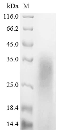 (Tris-Glycine gel) Discontinuous SDS-PAGE (reduced) with 5% enrichment gel and 15% separation gel.