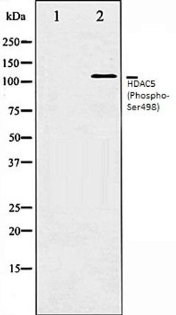 Western blot analysis of NIH-3T3 whole cell lysates using HDAC5 (Phospho-Ser498) antibody, The lane on the left is treated with the antigen-specific peptide.