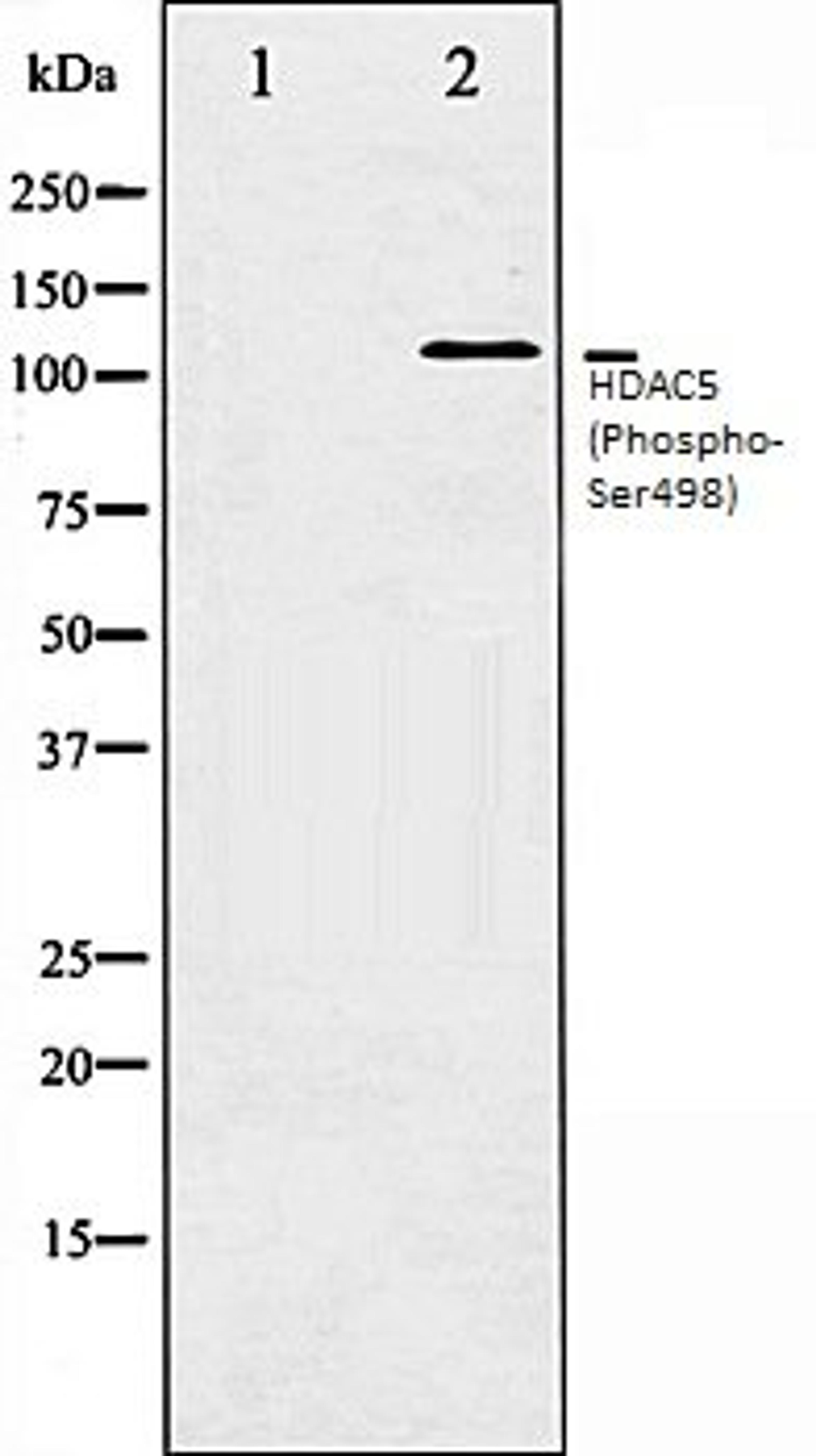 Western blot analysis of NIH-3T3 whole cell lysates using HDAC5 (Phospho-Ser498) antibody, The lane on the left is treated with the antigen-specific peptide.