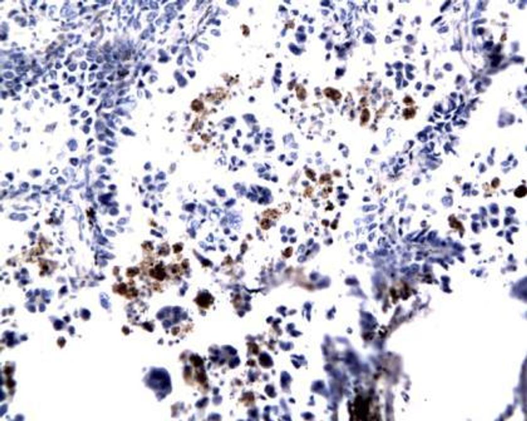 Immunohistochemical staining of paraffin embedded mouse lung tumor model using EAR1 antibody