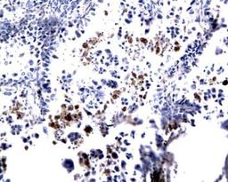 Immunohistochemical staining of paraffin embedded mouse lung tumor model using EAR1 antibody