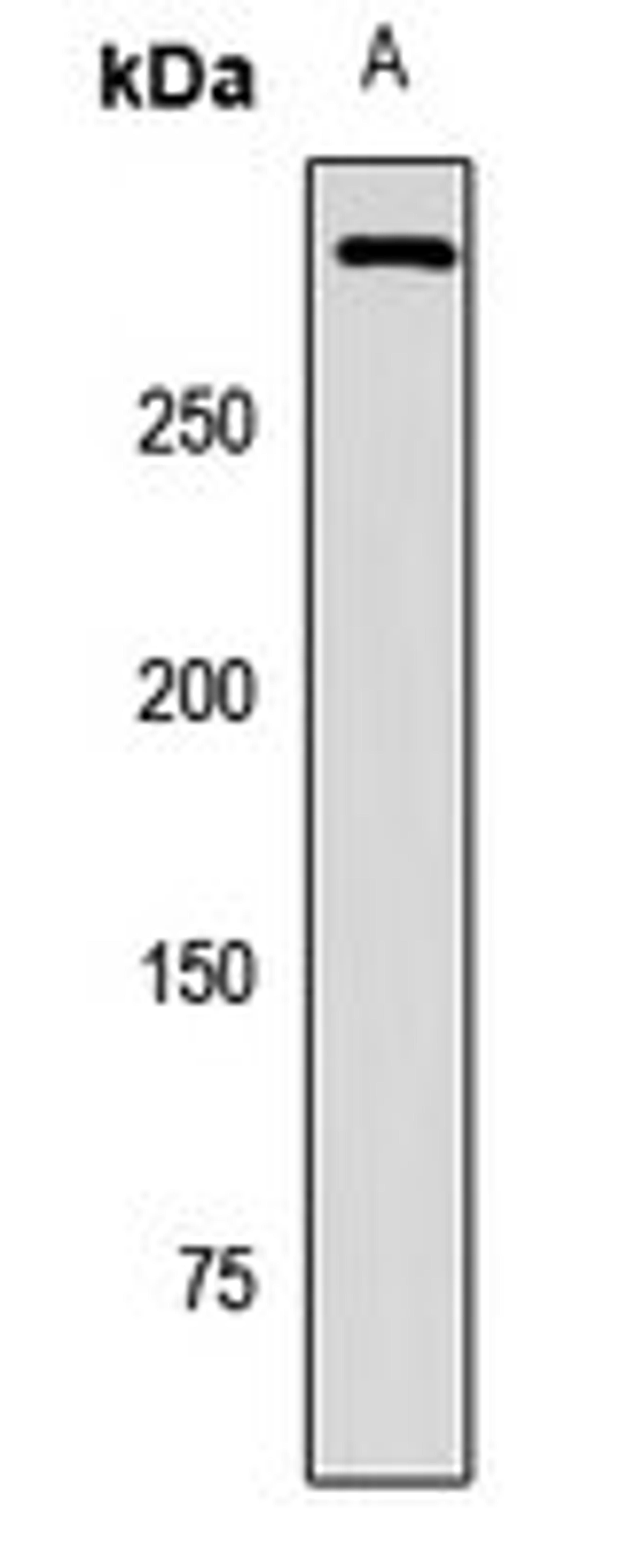 Western blot analysis of MCF7 (Lane1) whole cell lysates using PIEZO1 antibody