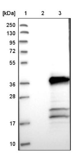 Western Blot: TMEM53 Antibody [NBP1-82124] - Lane 1: Marker [kDa] 250, 130, 95, 72, 55, 36, 28, 17, 10<br/>Lane 2: Negative control (vector only transfected HEK293T lysate)<br/>Lane 3: Over-expression lysate (Co-expressed with a C-terminal myc-DDK tag (~3.1 kDa) in mammalian HEK293T cells, LY411222)