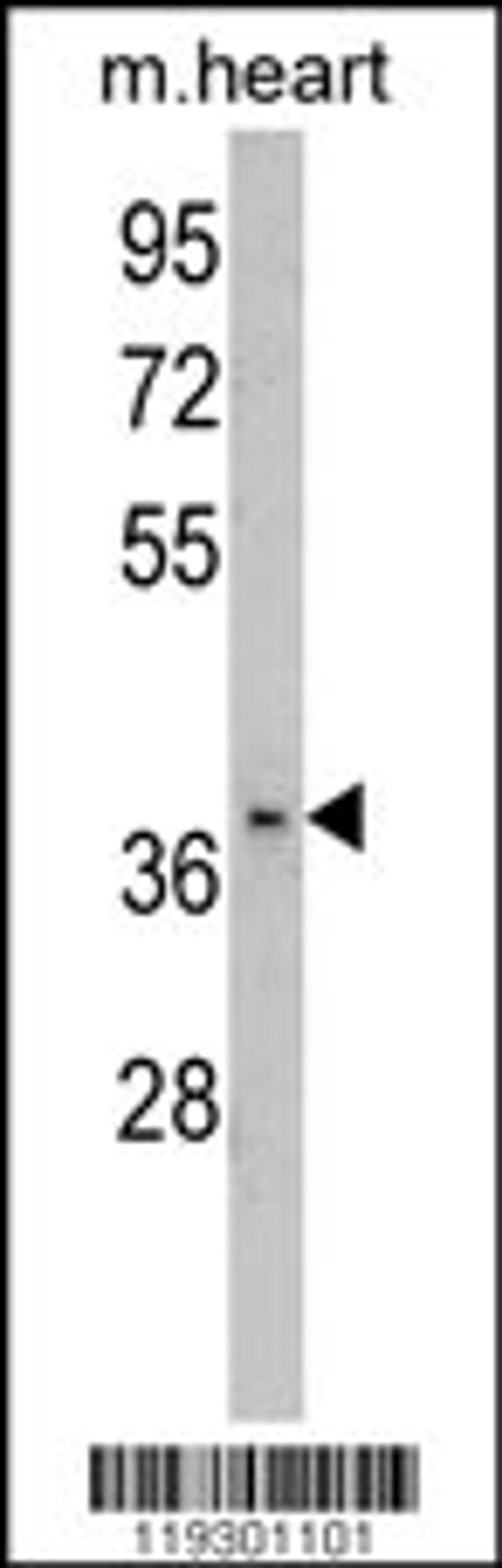 Western blot analysis of FBP2 Antibody in mouse heart tissue lysates (35ug/lane)