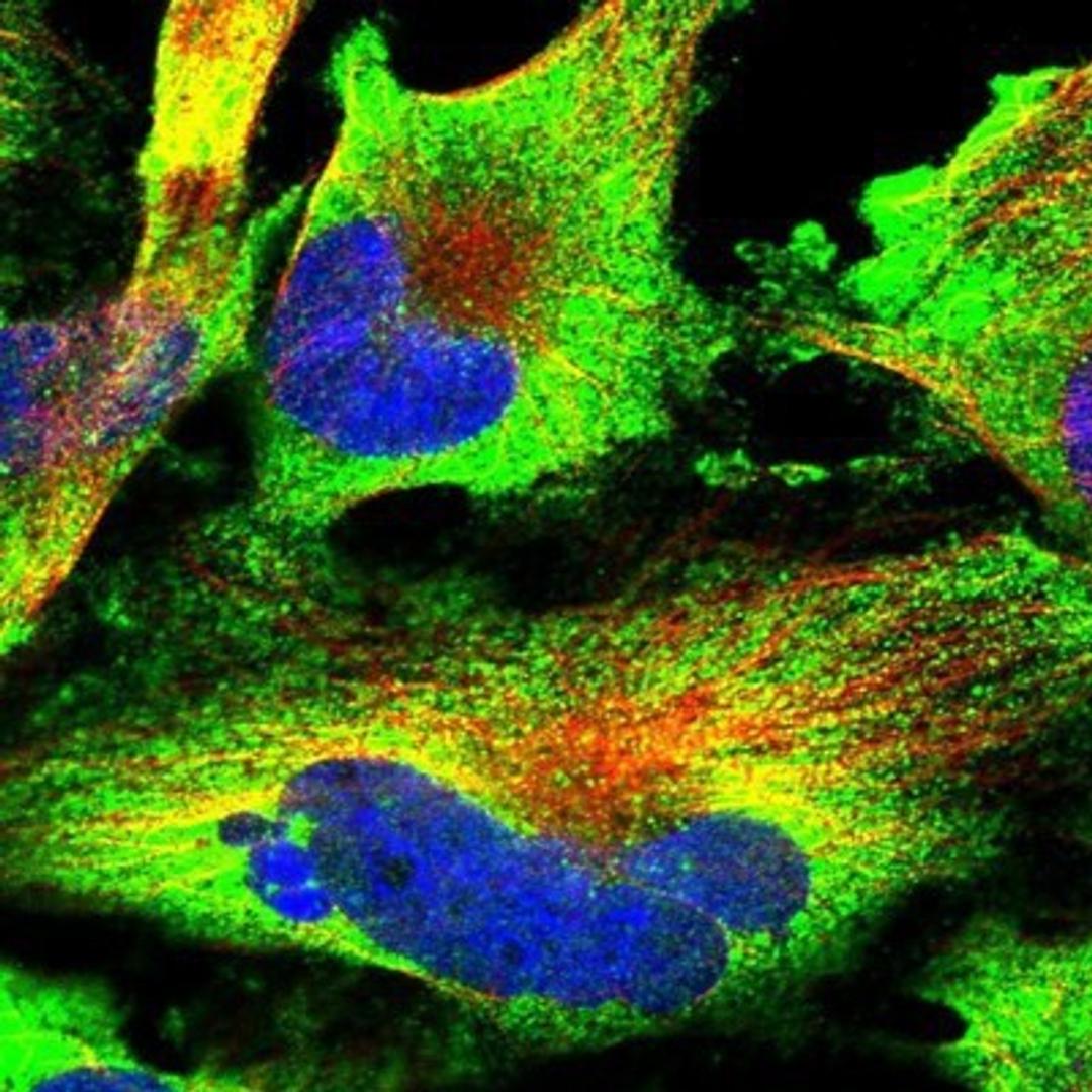 Immunocytochemistry/Immunofluorescence: DOCK3 Antibody [NBP1-93647] - Staining of human cell line U-251 MG shows positivity in cytoplasm.