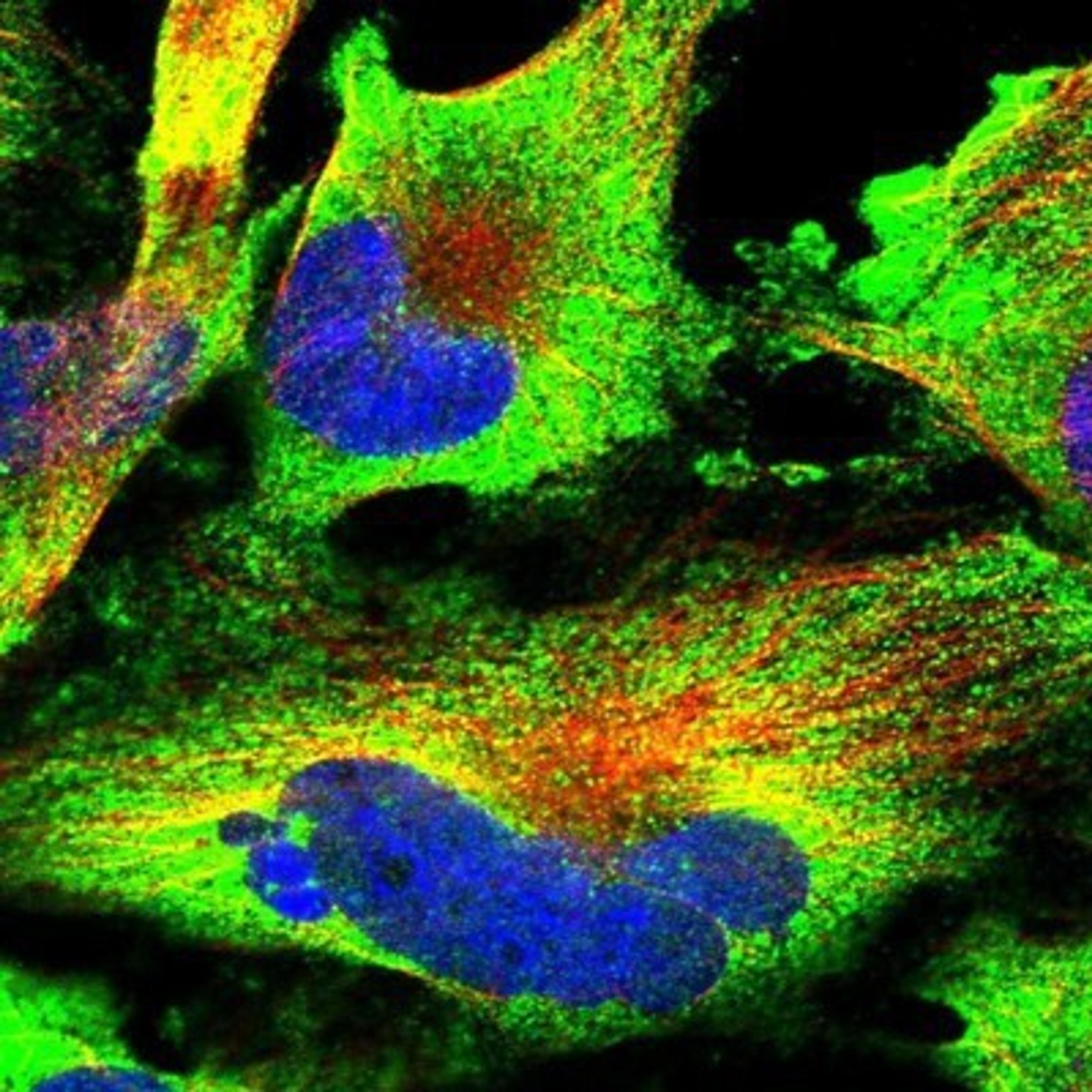 Immunocytochemistry/Immunofluorescence: DOCK3 Antibody [NBP1-93647] - Staining of human cell line U-251 MG shows positivity in cytoplasm.