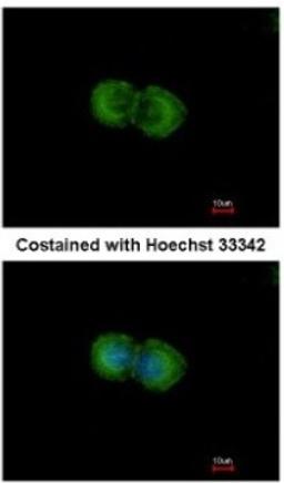 Immunocytochemistry/Immunofluorescence: LIN7 Antibody [NBP2-15016] - Analysis of methanol-fixed MCF-7, using antibody at 1:500 dilution.