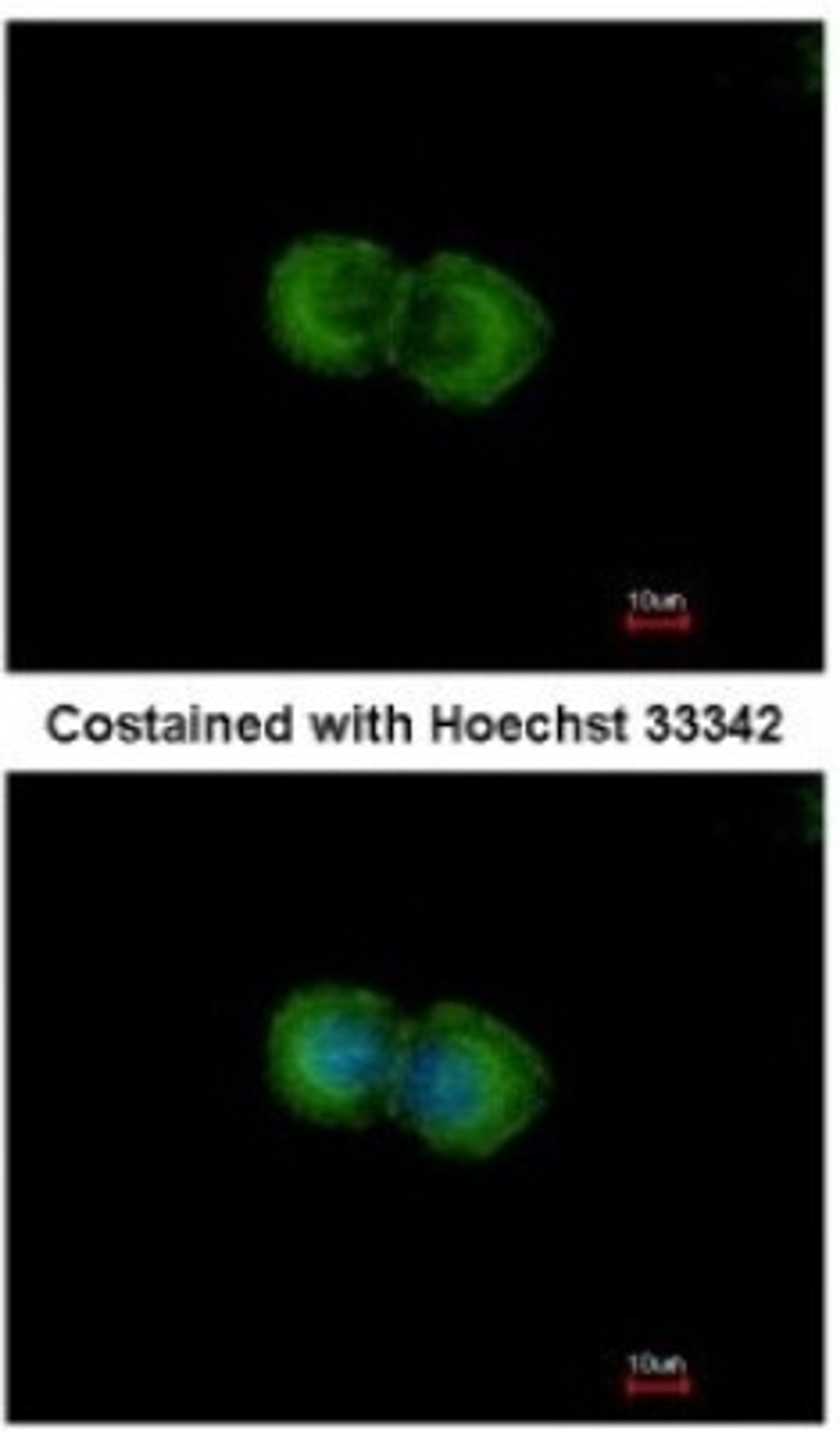 Immunocytochemistry/Immunofluorescence: LIN7 Antibody [NBP2-15016] - Analysis of methanol-fixed MCF-7, using antibody at 1:500 dilution.