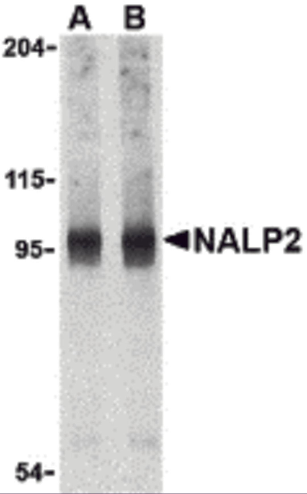 Western blot analysis of NALP2 in PC-3 cell lysate with NALP2 antibody at (A) 1 and (B) 2 &#956;g/mL.