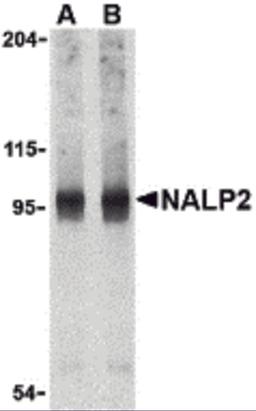 Western blot analysis of NALP2 in PC-3 cell lysate with NALP2 antibody at (A) 1 and (B) 2 &#956;g/mL.