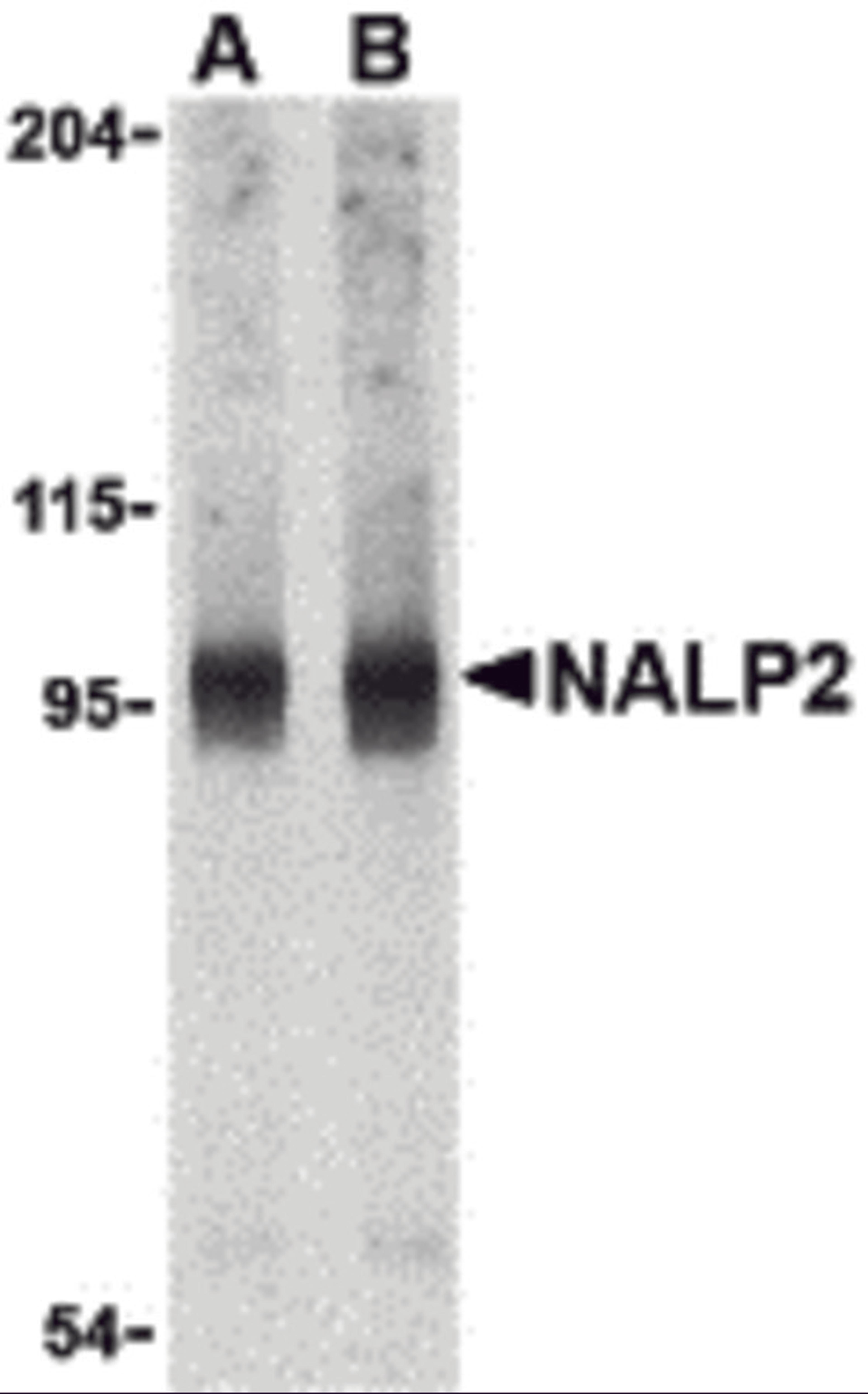 Western blot analysis of NALP2 in PC-3 cell lysate with NALP2 antibody at (A) 1 and (B) 2 &#956;g/mL.