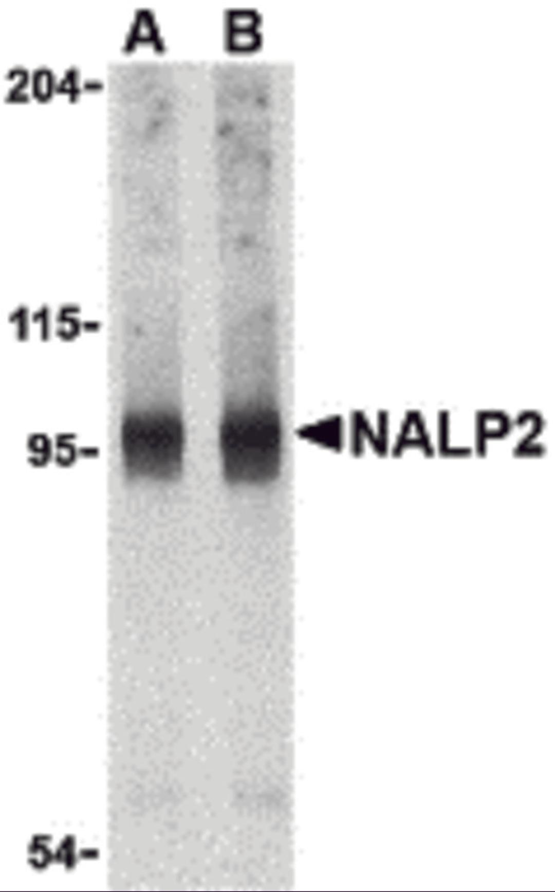 Western blot analysis of NALP2 in PC-3 cell lysate with NALP2 antibody at (A) 1 and (B) 2 μg/mL.