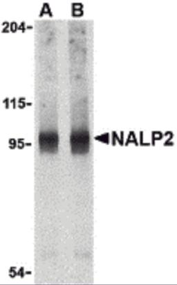 Western blot analysis of NALP2 in PC-3 cell lysate with NALP2 antibody at (A) 1 and (B) 2 μg/mL.